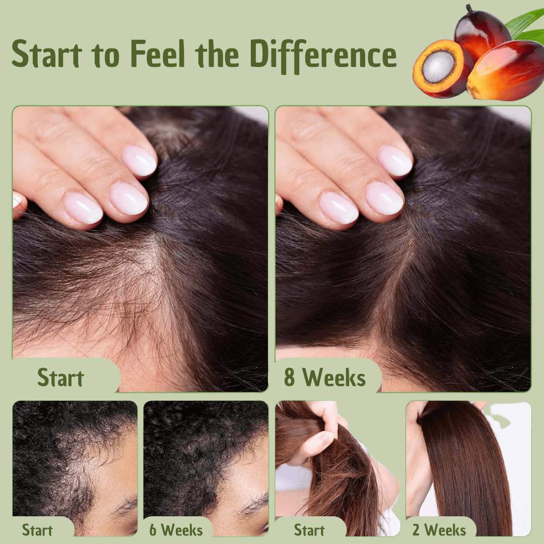 Batana Hair Oil | Deep Hydration, Strengthening & Protection for Healthy, Vibrant Hair