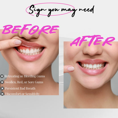 Effective Gum Disease Treatment – Red Light Therapy for Swollen Gums & Receding Gums