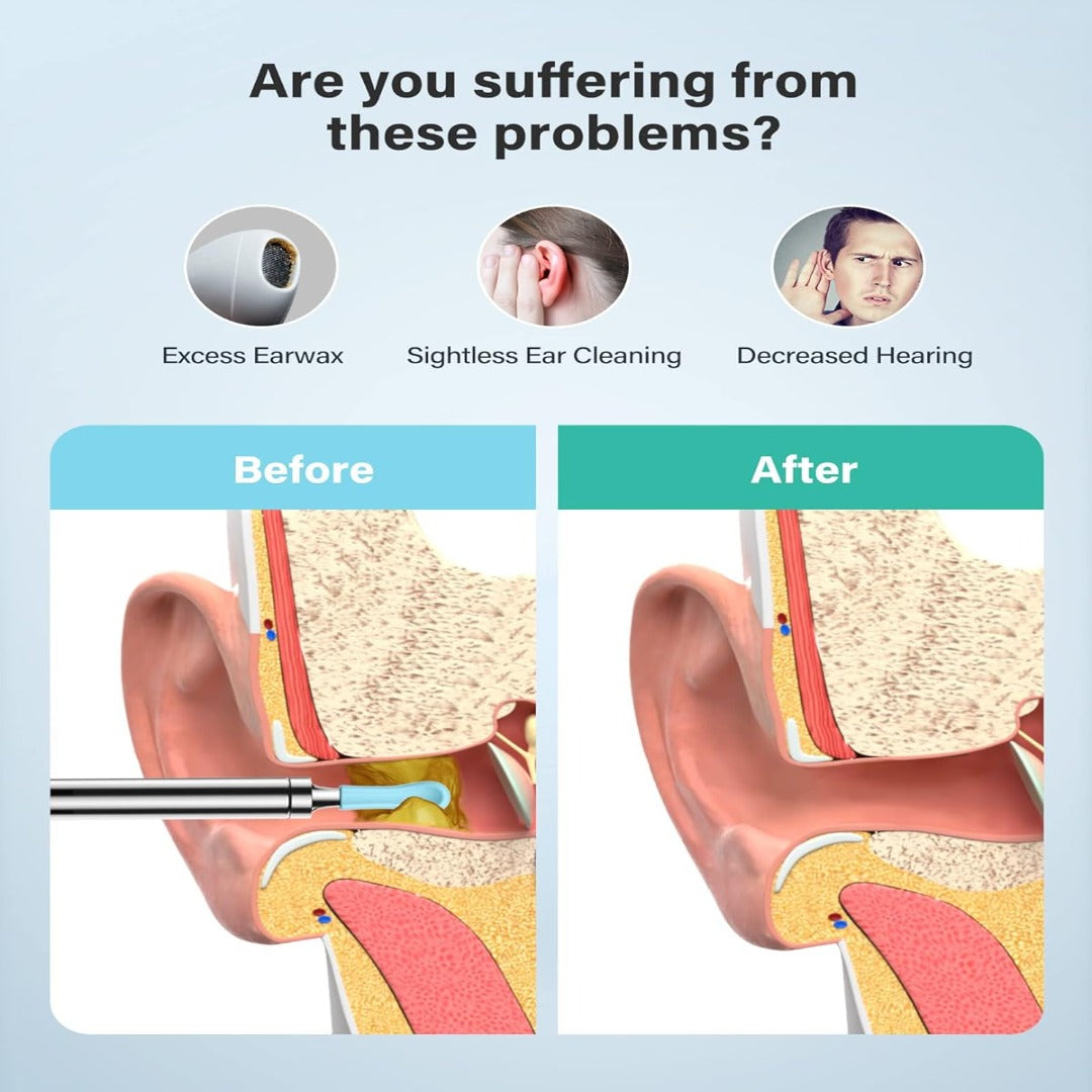 Ear Wax Removal Syringe Kit – Safe Water Irrigation System for Gentle Ear Cleaning