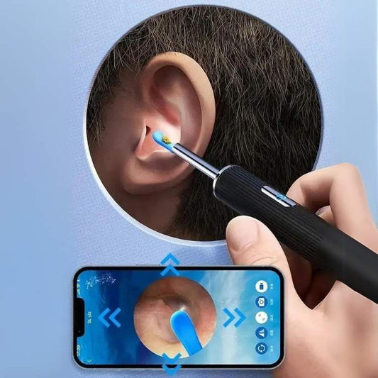 EarScope Pro Ear Wax Removal Kit | High-Resolution Camera & LED Lights for Safe Home Use