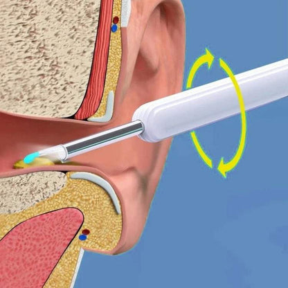 EarScope Pro Ear Wax Removal Kit | High-Resolution Camera & LED Lights for Safe Home Use