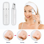 Facial Skin Cleansing Brush – Ultrasonic Skin Scrubber Device for Deep Clean & Pore Refinement