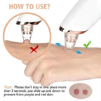 AeriaSkin™ Blackhead Remover Vacuum Pore Cleaner | Adjustable Suction, Multi-Functional Tool for Deep Cleansing & Acne Treatment at Home