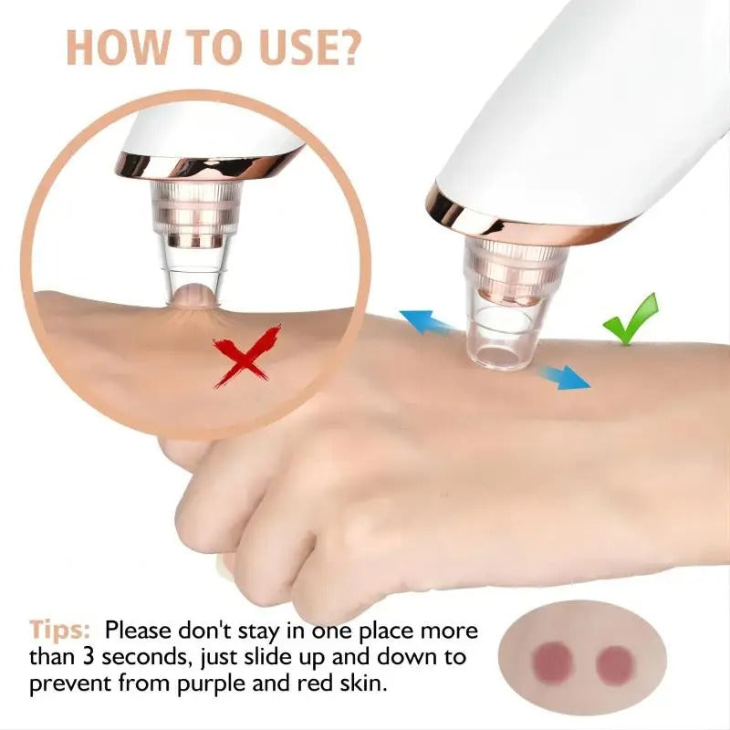 AeriaSkin™ Blackhead Remover Vacuum Pore Cleaner | Adjustable Suction, Multi-Functional Tool for Deep Cleansing & Acne Treatment at Home