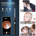 Ear Wax Removal Tool | 1080P HD Camera, LED Lights & Adjustable Scoops for Safe Ear Hygiene at Home