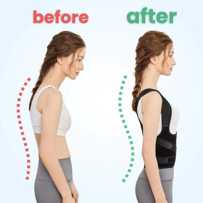 Back Posture Corrector | Adjustable, Breathable Design for Men & Women to Improve Posture and Reduce Back Pain