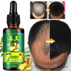 Image of Hair Regrow Oil | 7 Day Hair Regrowth Ginger Serum